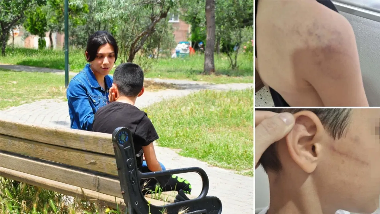 Manisa'da akılalmaz olay: Öğretmeninden harçlık istedi diye oğlunu darbetti!