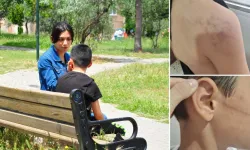 Manisa'da akılalmaz olay: Öğretmeninden harçlık istedi diye oğlunu darbetti!