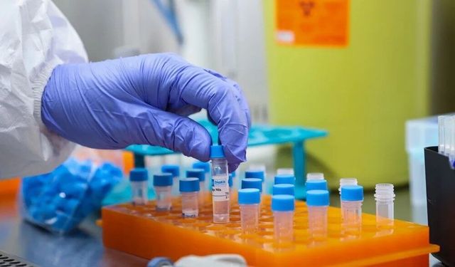 Salgın hastalıklara yerli çözüm: Tanı kitleri üretimine başlandı